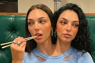 Сиамские близнецы обрели популярность в соцсетях — это оказался ИИ