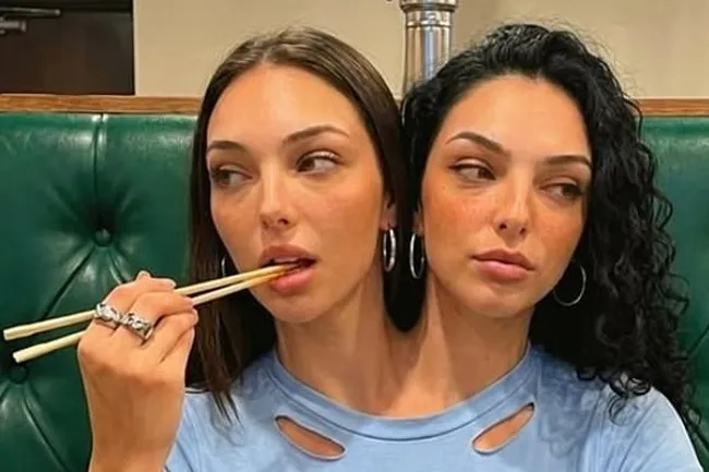 Сиамские близнецы обрели популярность в соцсетях — это оказался ИИ