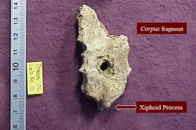 Отверстие в груди выдало убийство! Как археологи раскрыли древнее преступление