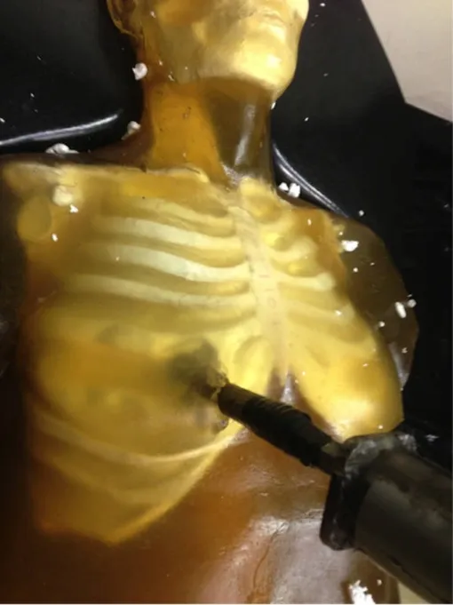 3D-печатная модель туловища мужчины с копией стиракса, пронизывающего грудину. /