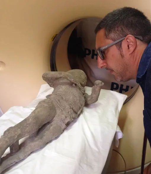 Vezüv Yanardağı'nın patlamasının kurbanlarından biri.