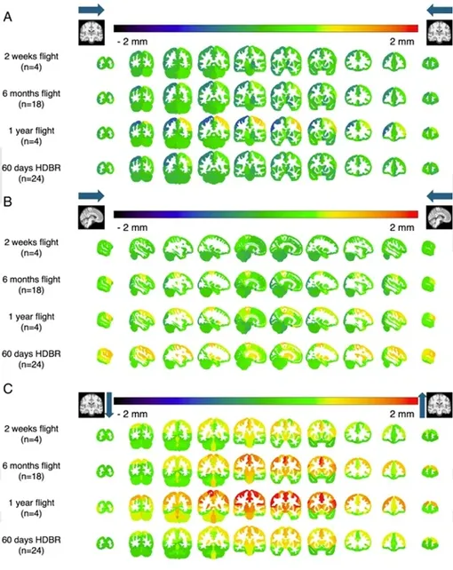 Величина смещения положения мозга, с участниками, разбитыми на группы по ~2 недели, ~6 месяцев и ~1 год в пространстве.