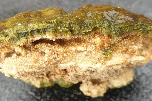 Ммикробиалит