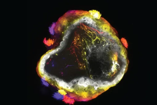 Нейробот, окрашенный для выделения многоресничных клеток — с небольшими пучками волоскоподобных ресничек по периферии бота — и нейронных отростков дендритов и аксонов, видимых в центре.