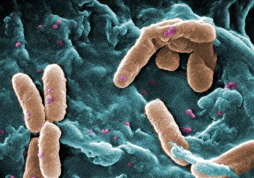Синегнойная палочка. Многолекарственно-устойчивая Pseudomonas aeruginosa.