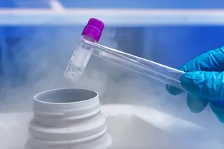 Выращивание собственных стволовых клеток может помочь от болезни Паркинсона Выращивание собственных стволовых клеток может помочь от болезни Паркинсона