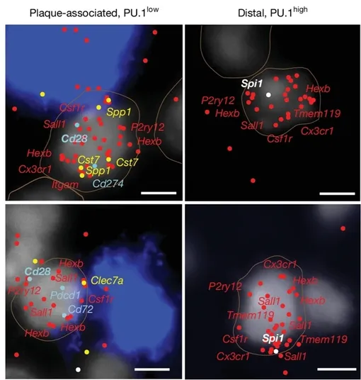 Лимфоидные гены, экспрессирующие кортикальные клетки микроглии, локализуются вблизи амилоидных бляшек. Лимфоидные гены, экспрессирующие кортикальные клетки микроглии, локализуются вблизи амилоидных бляшек.