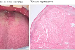 Загадочная шишка на языке не давала покоя мужчине — но ее причина поразила даже врачей Загадочная шишка на языке не давала покоя мужчине — но ее причина поразила даже врачей