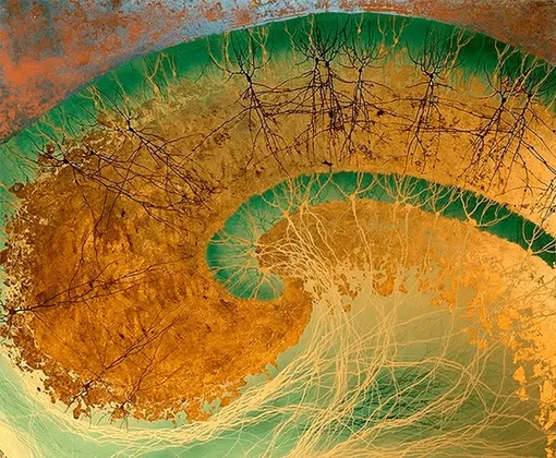 Гиппокамп. Его специализация — память, но он же играет огромную роль и во многих других мозговых процессах.