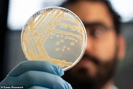 Eurac Research'ten araştırmacılar, Ötzi'nin mumyalanmış kalıntıları üzerinde yaşayan mikroorganizmaların ayrıntılı bir görüntüsünü ilk kez elde ettiler.