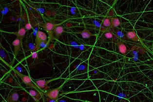 Ученые разработали «световой выключатель» для гормона любви