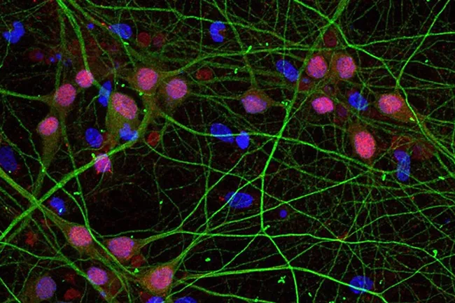Ученые разработали «световой выключатель» для гормона любви
