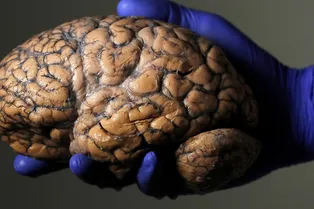 Живой мозг «из пробирки» сам присоединяет себя к тканям тела Живой мозг «из пробирки» сам присоединяет себя к тканям тела