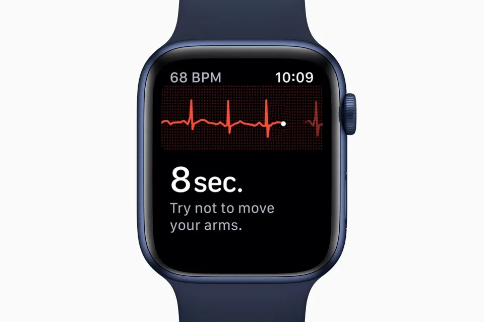 ИИ смог определить сердечную патологию по данным Apple Watch