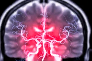 Срочно на диету: потеря веса замедляет старение мозга минимум на 9 месяцев Срочно на диету: потеря веса замедляет старение мозга минимум на 9 месяцев