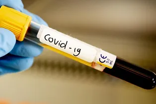 Число заболевших COVID-19 в РФ превысило 177 тысяч
