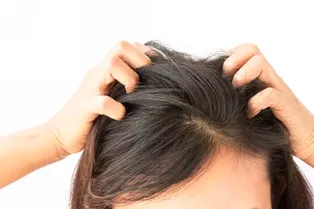 Почему чешется голова и когда нужно к врачу