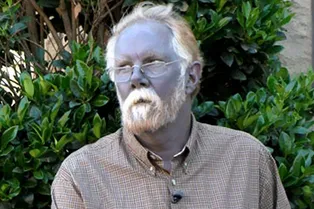 Он буквально посинел после многолетнего приема «домашних пищевых добавок»!