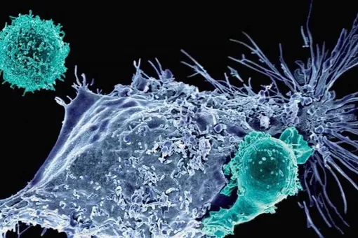 CAR-T клетки атакуют опухоль.