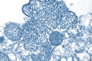 Почему так опасен вирус Нипах, если были только единичные случаи заражения Почему так опасен вирус Нипах, если были только единичные случаи заражения