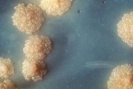 Палочка Коха. Mycobacterium tuberculosis на культуре.