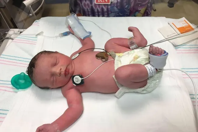 Удивительная история Линли Хоуп — девочки, которая рождалась дважды