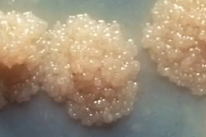 Туберкулез отобрал у COVID'а звание самой смертоносной инфекции