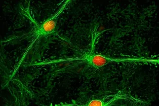 Ученые нашли в мозге «выключатель» хронической боли Ученые нашли в мозге «выключатель» хронической боли