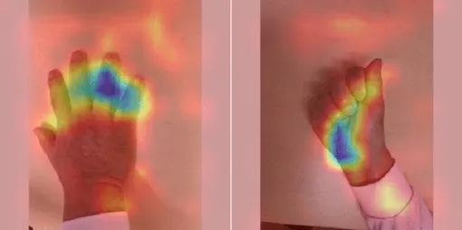 Анализ руки