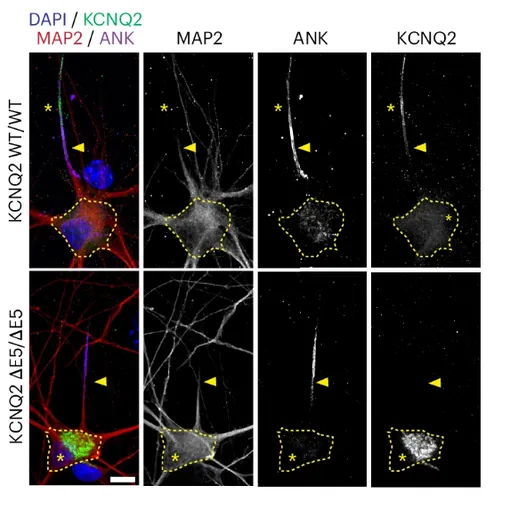 Репрезентативные иммуноцитохимические изображения нейронов, окрашенных DAPI, MAP2, KCNQ2 и ANK-G. Репрезентативные иммуноцитохимические изображения нейронов