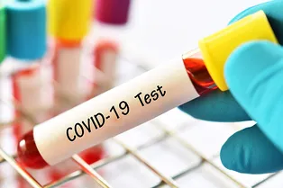 Число заболевших COVID-19 в РФ превысило 80 тысяч