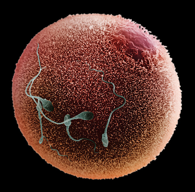 Сперматозоидтік ұшу