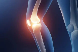 В США создали гель, который снизит боль от артрита В США создали гель, который снизит боль от артрита