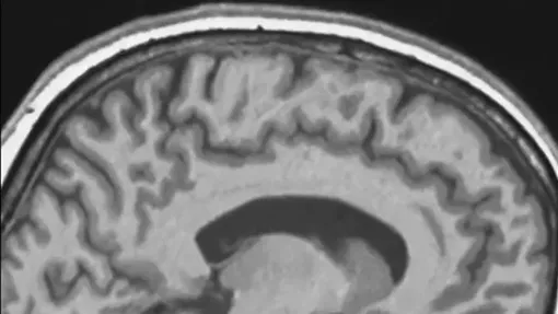 Какое влияние оказывают космические полеты на мозг космонавтов?