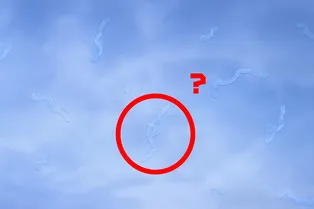 Почему время от времени перед глазами появляются темные или полупрозрачные «мушки»? Почему время от времени перед глазами появляются темные или полупрозрачные «мушки»?