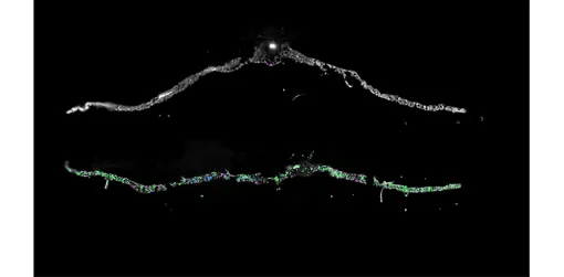 Поперечный разрез листа Arabidopsis в условиях засухи