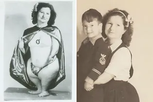 «Девушка-пингвин»: как редкое генетическое заболевание привело Рут Берри во фрик-шоу