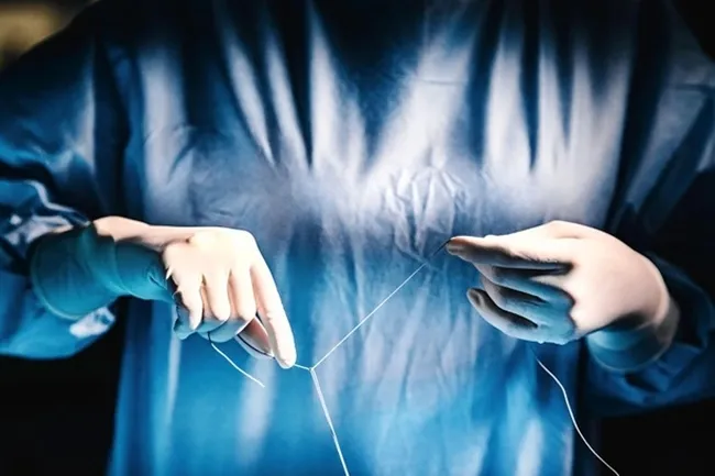 «Программируемые» узелки страхуют хирурга от повреждения тканей