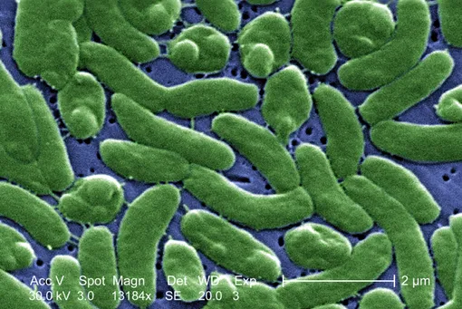 Vibrio vulnificus Vibrio vulnificus
