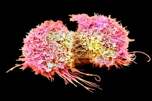 Опухоли захватывают сенсорные нейроны, чтобы отключить иммунную систему