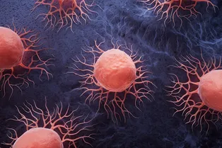 Ученые разгадали тайну высокой смертности от рака поджелудочной железы