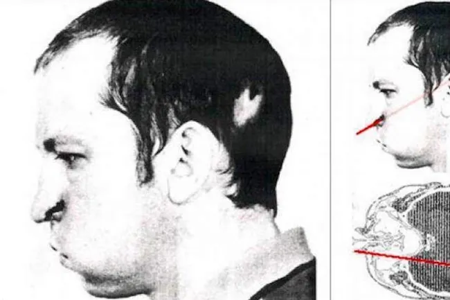 Физик сунул голову в протонный ускоритель и выжил! История Анатолия Бугорского