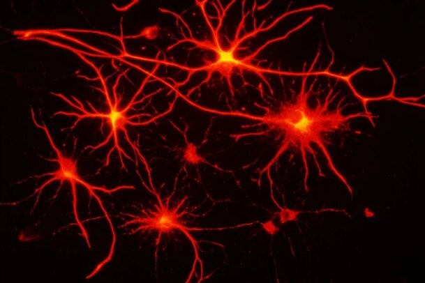 Нейробиологи построили карту «скрытой» транспортной сети мозга