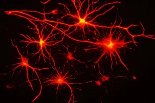 Нейробиологи построили карту «скрытой» транспортной сети мозга
