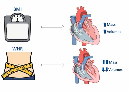 На изображении демонстрируется, какие изменения в структуре сердца вызывают разные типы ожирения. Увеличение ОТ/ОБ было связано с увеличением массы левого желудочка и уменьшением объемов обоих желудочков. Увеличение ИМТ связано с дилатацией желудочков и увеличением массы левого желудочка. На изображении демонстрируется, какие изменения в структуре сердца вызывают разные типы ожирения. Увеличение ОТ/ОБ было связано с увеличением массы левого желудочка и уменьшением объемов обоих желудочков. Увеличение ИМТ связано с дилатацией желудочков и увеличением массы левого желудочка.
