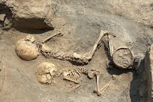 В Узбекистане нашли череп ребенка со следами древнейшей в Центральной Азии операции на мозге