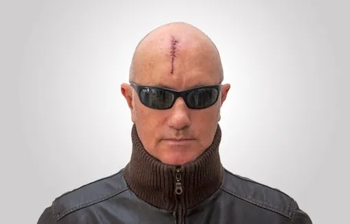 лысый мужчина со шрамом лысый мужчина со шрамом