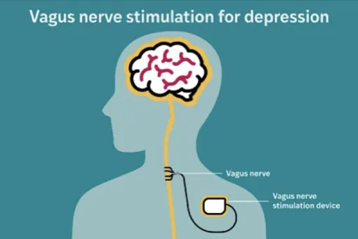 работа импланта