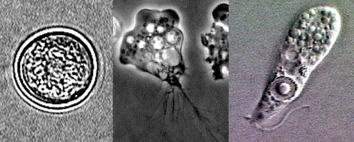 Naegleria fowleri,