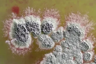 В почве обнаружен новый мощный антибиотик, убивающий супербактерии В почве обнаружен новый мощный антибиотик, убивающий супербактерии